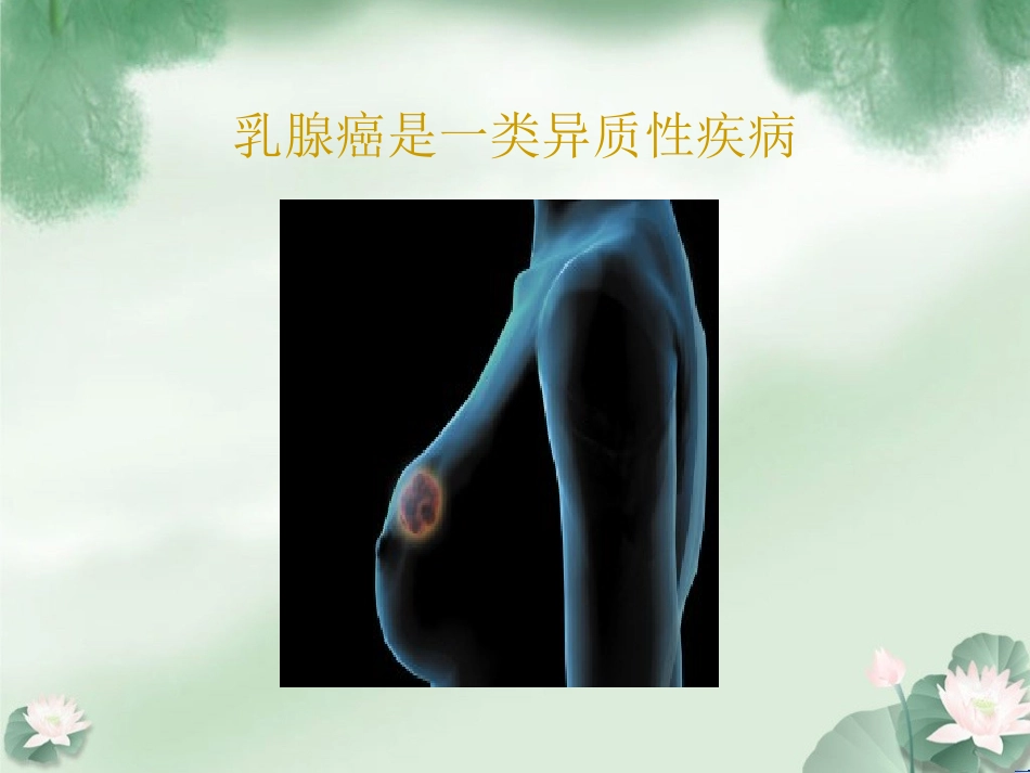 乳腺癌病例讨论PPT培训课件_第2页