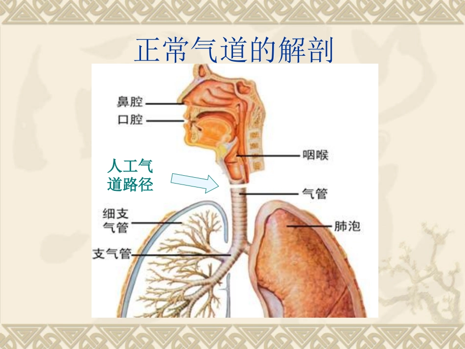 人工气道的建立PPT培训课件_第2页