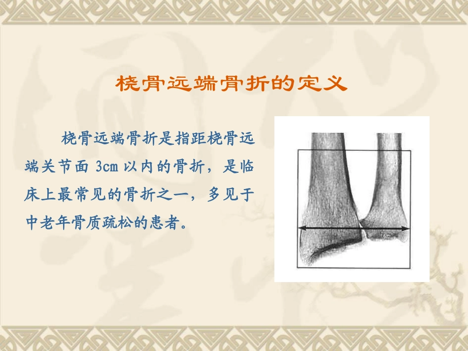 桡骨远端骨折PPT培训课件_第2页