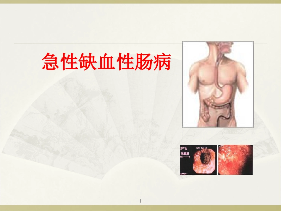 缺血性肠病!医学PPT培训课件_第1页