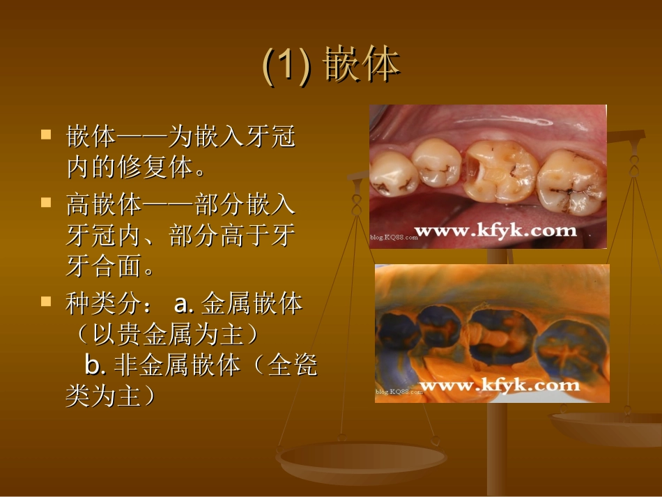 前牙美容修复PPT培训课件_第3页