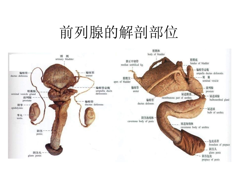 前列腺增生症PPT培训课件_第2页