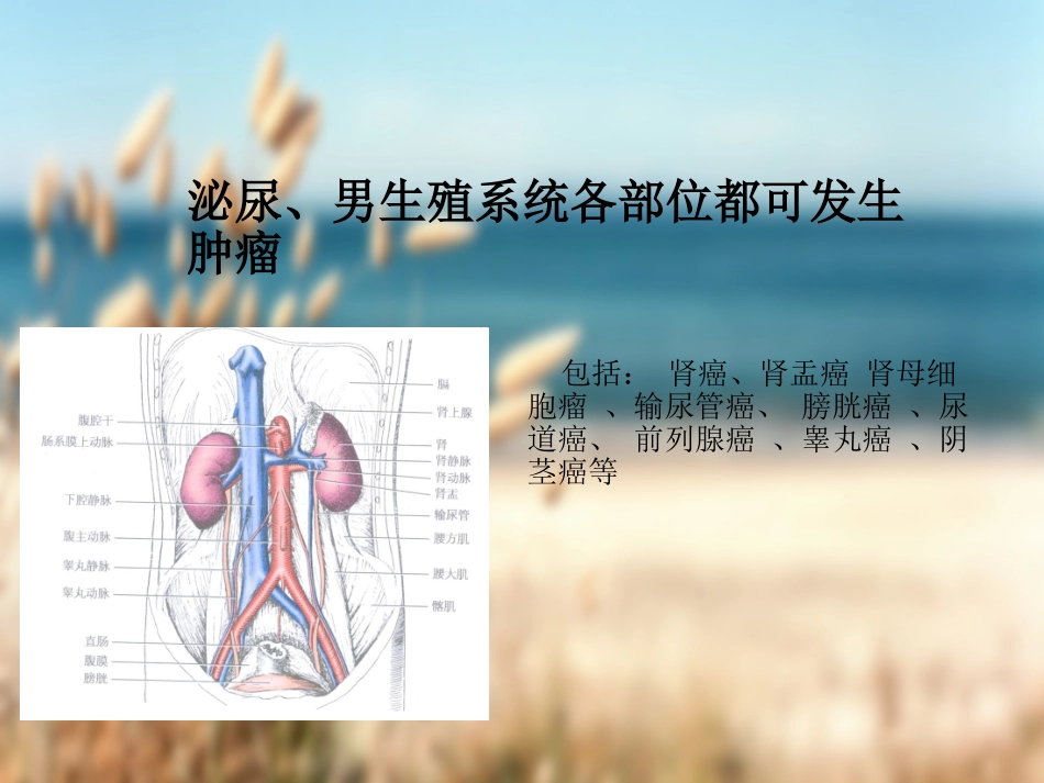 前列腺癌查房PPT培训课件_第2页