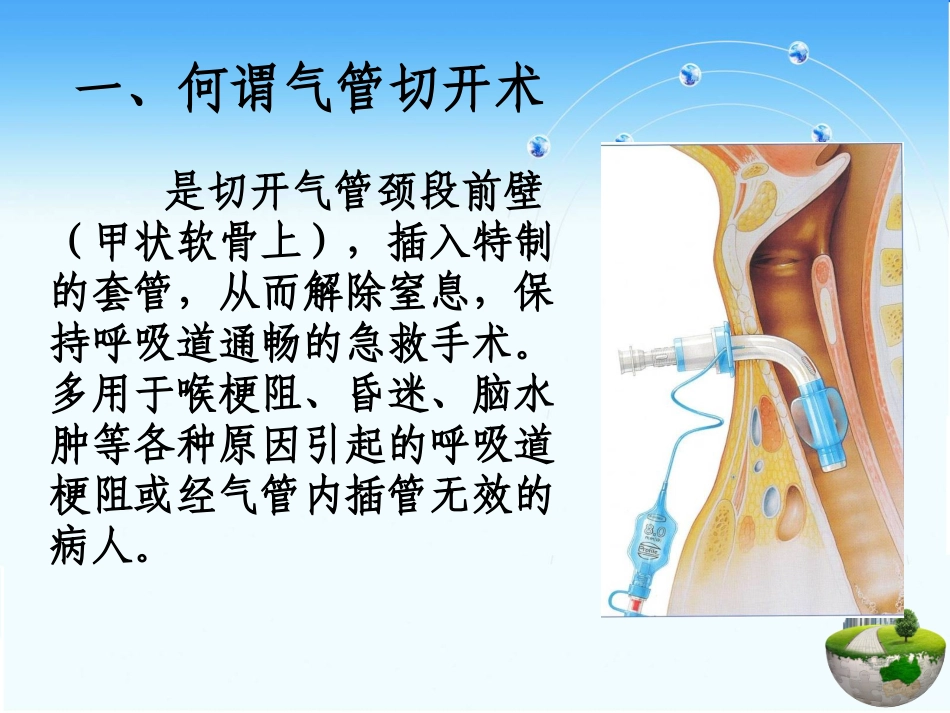 气管切开护理PPT培训课件_第2页