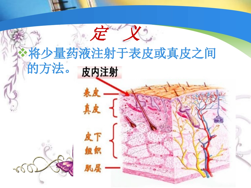 皮内注射法产科PPT培训课件_第3页