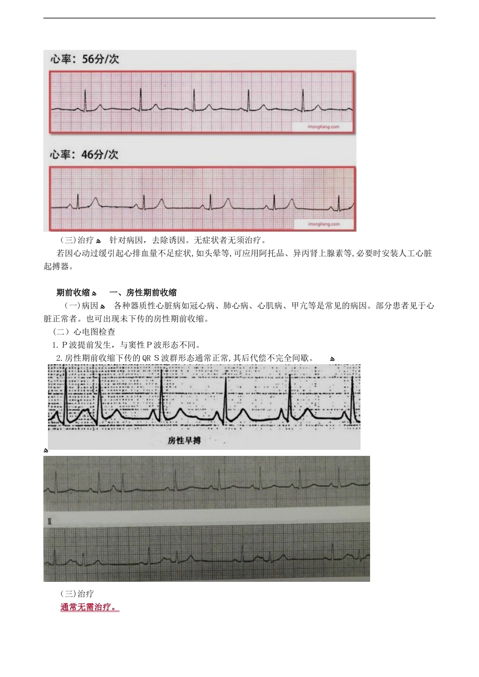 2024年心律失常考点总结_第2页
