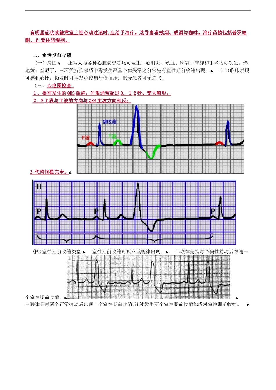 2024年心律失常考点总结_第3页