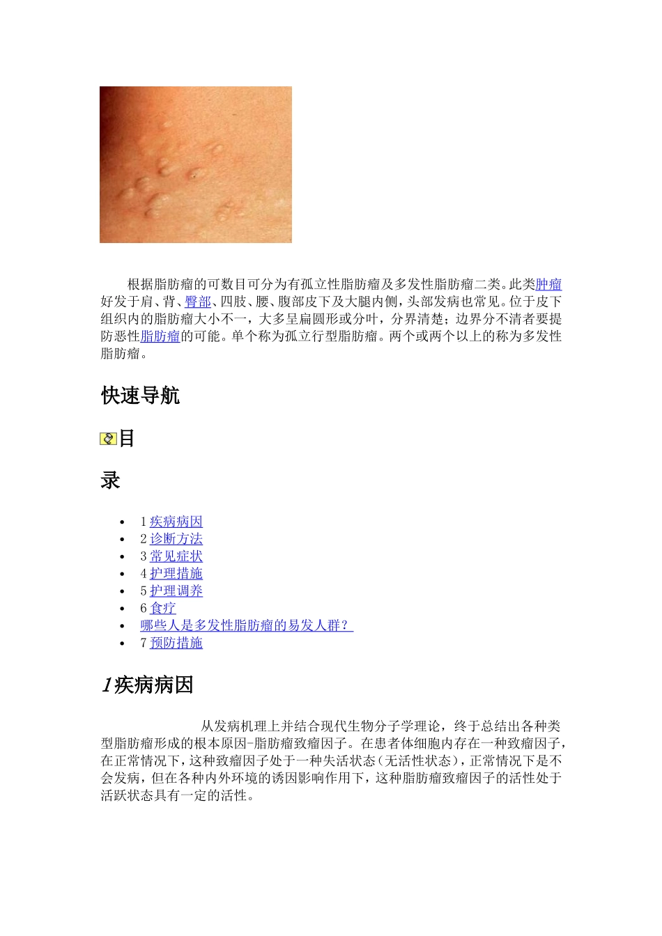 多发性脂肪瘤_第1页