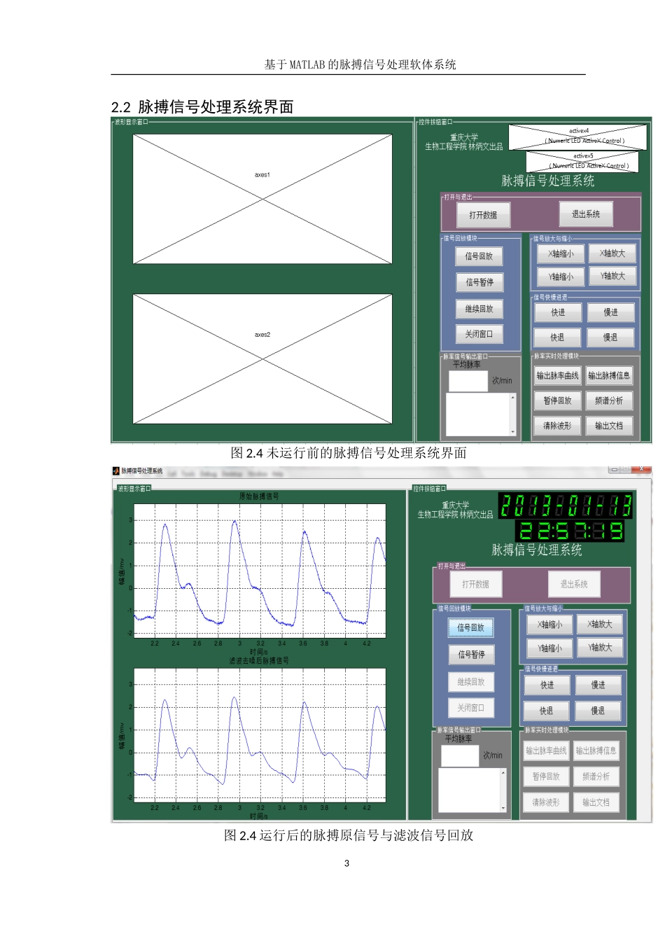 基于MATLAB-的脉搏信号处理软件系统_第3页