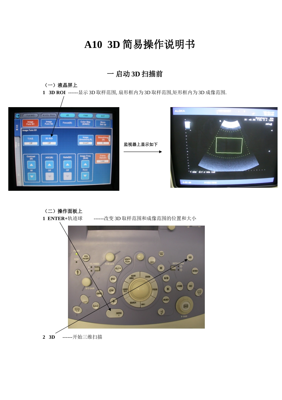 四维彩超操作说明书_第1页