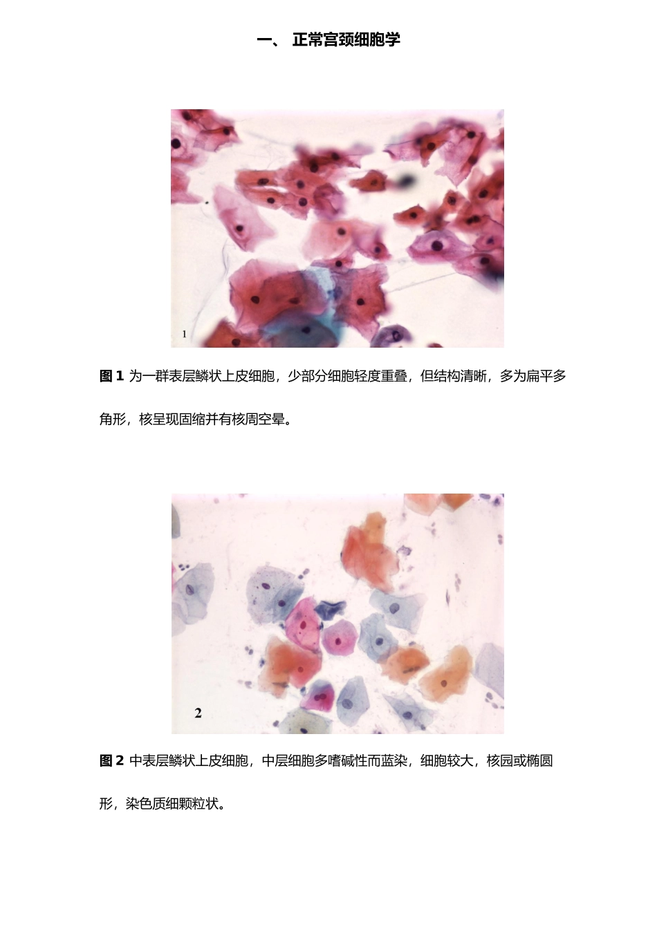 图谱宫颈细胞学_第1页