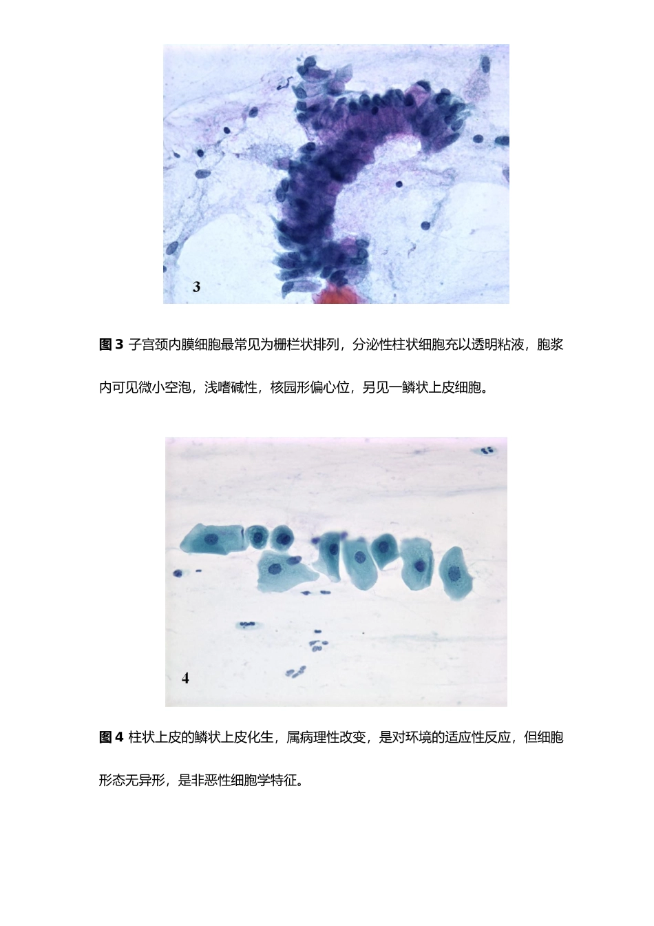 图谱宫颈细胞学_第2页