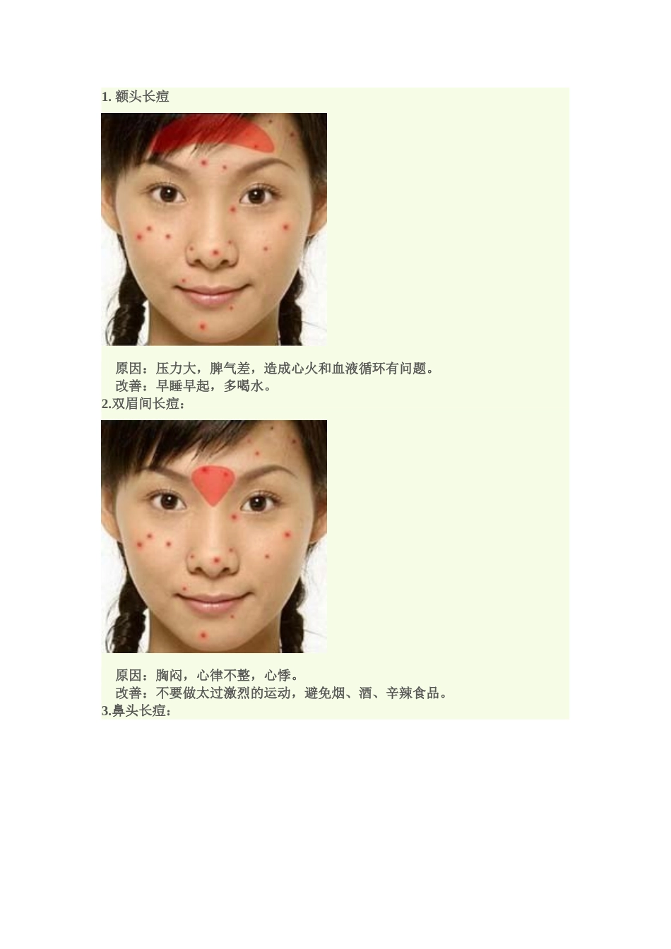 图解不同部位长痘痘的原因_第1页
