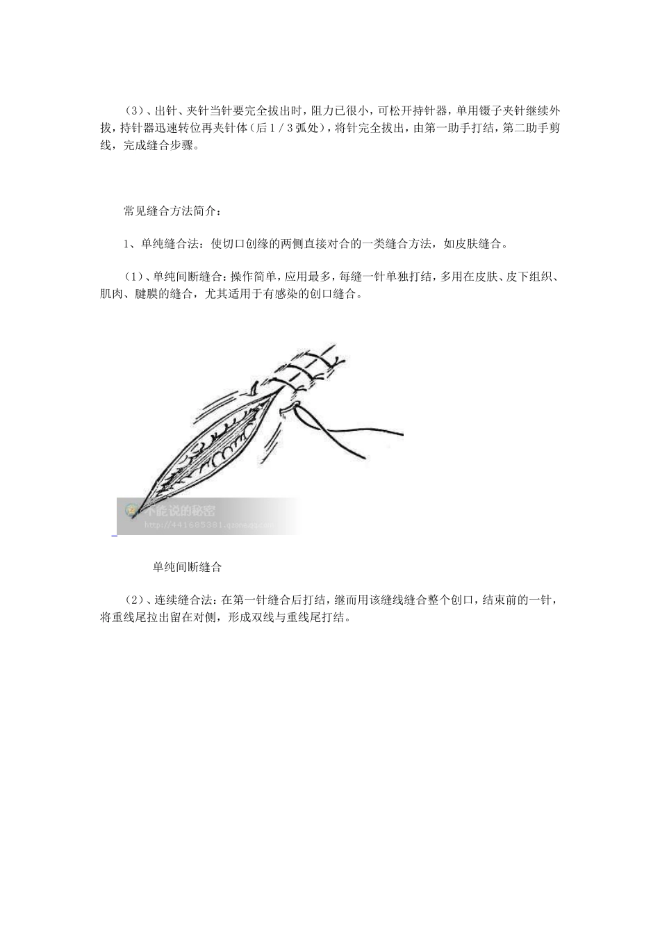 外科缝合的基本方法_第2页