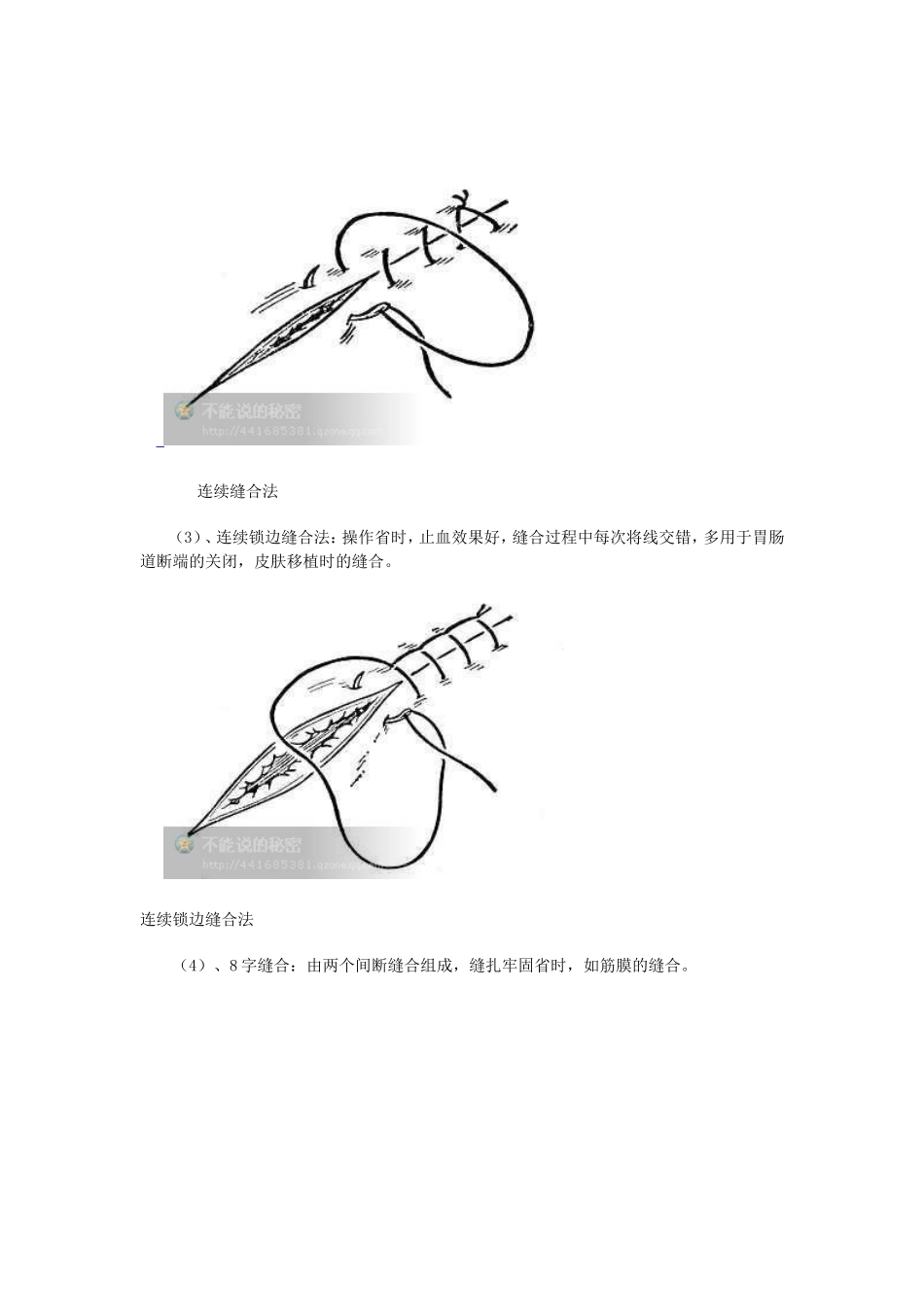 外科缝合的基本方法_第3页