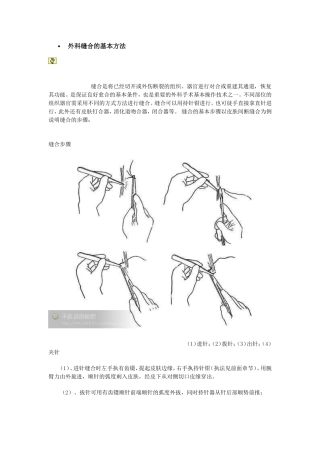 外科缝合的基本方法