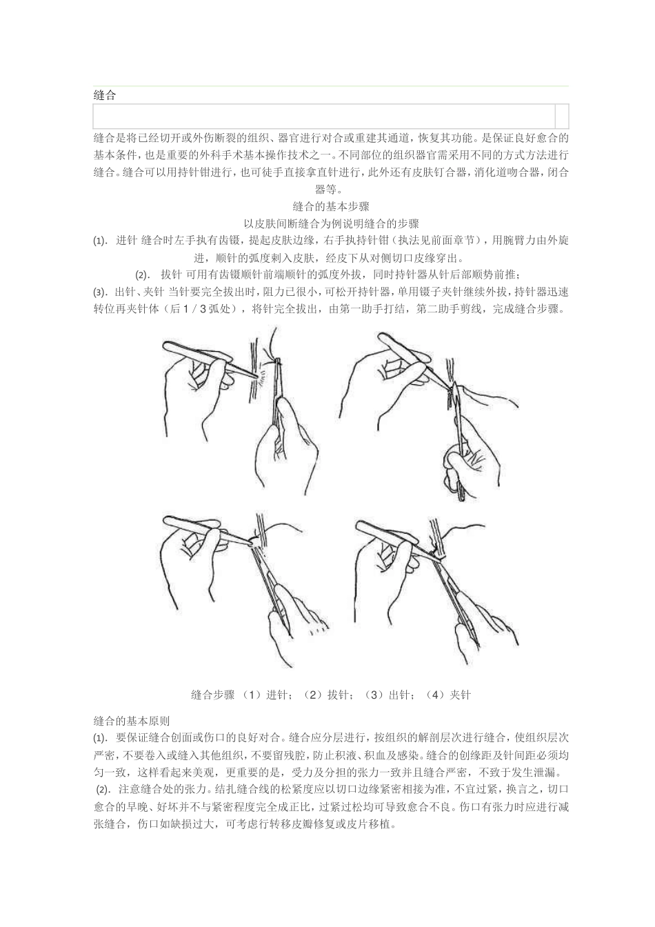 外科缝合手法图文讲解_第1页