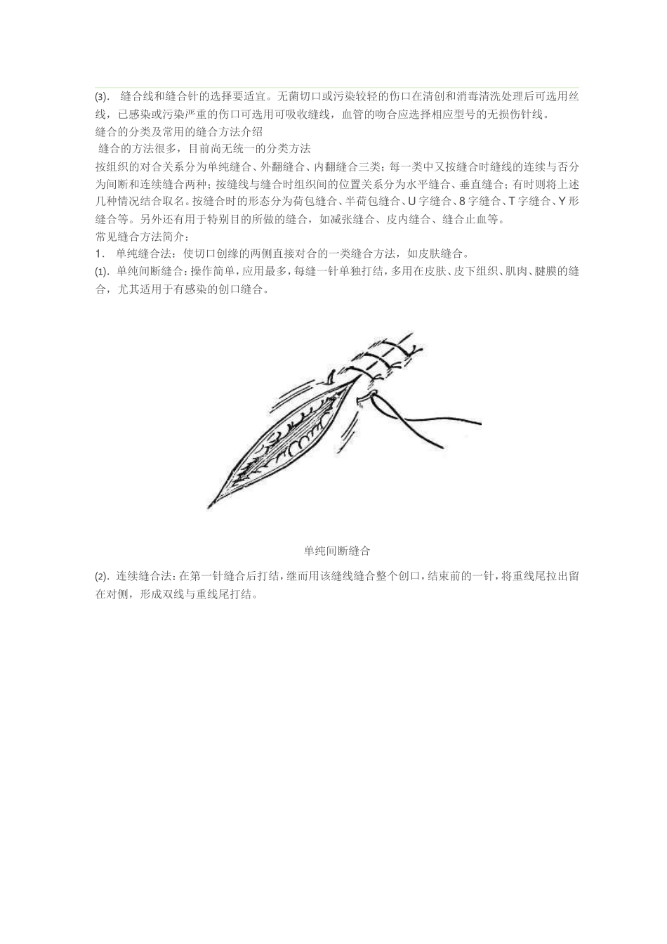 外科缝合手法图文讲解_第2页