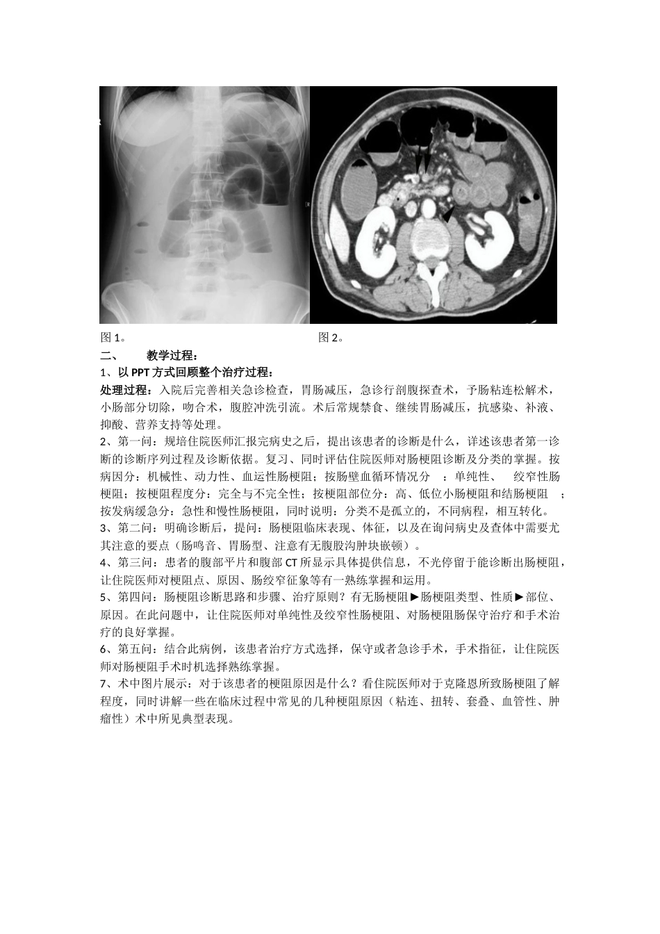 外科教学查房教案_第2页