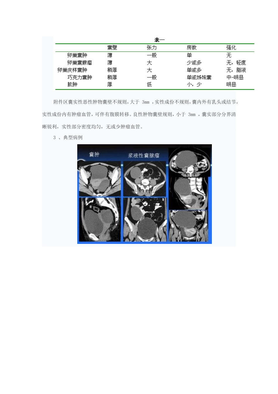 卵巢肿瘤的鉴别诊断_第3页