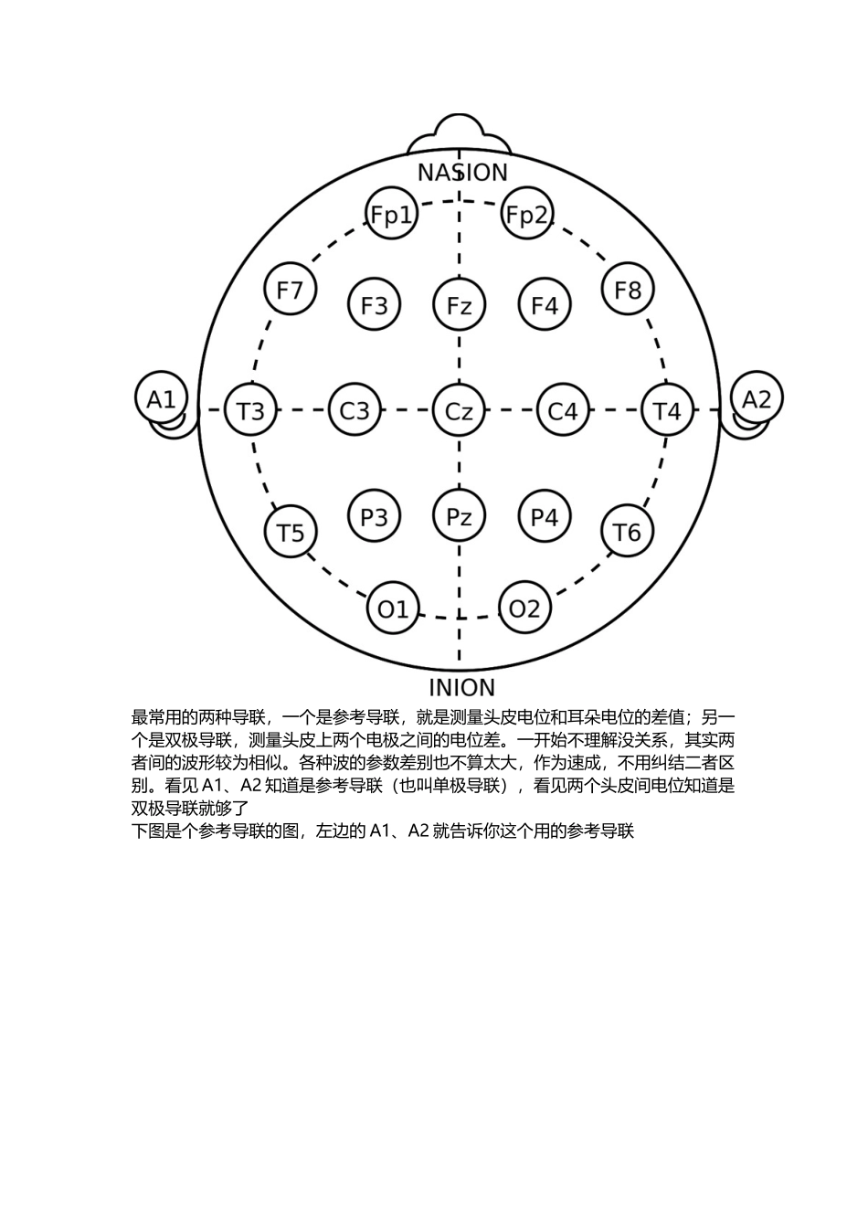 你一定喜欢的脑电图速成_第2页