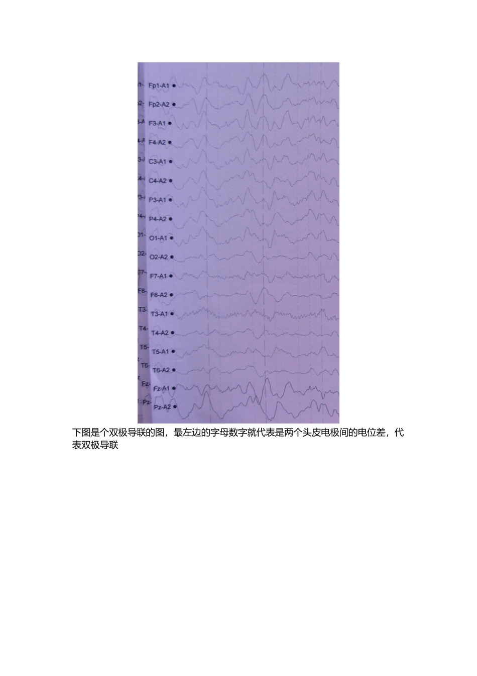 你一定喜欢的脑电图速成_第3页