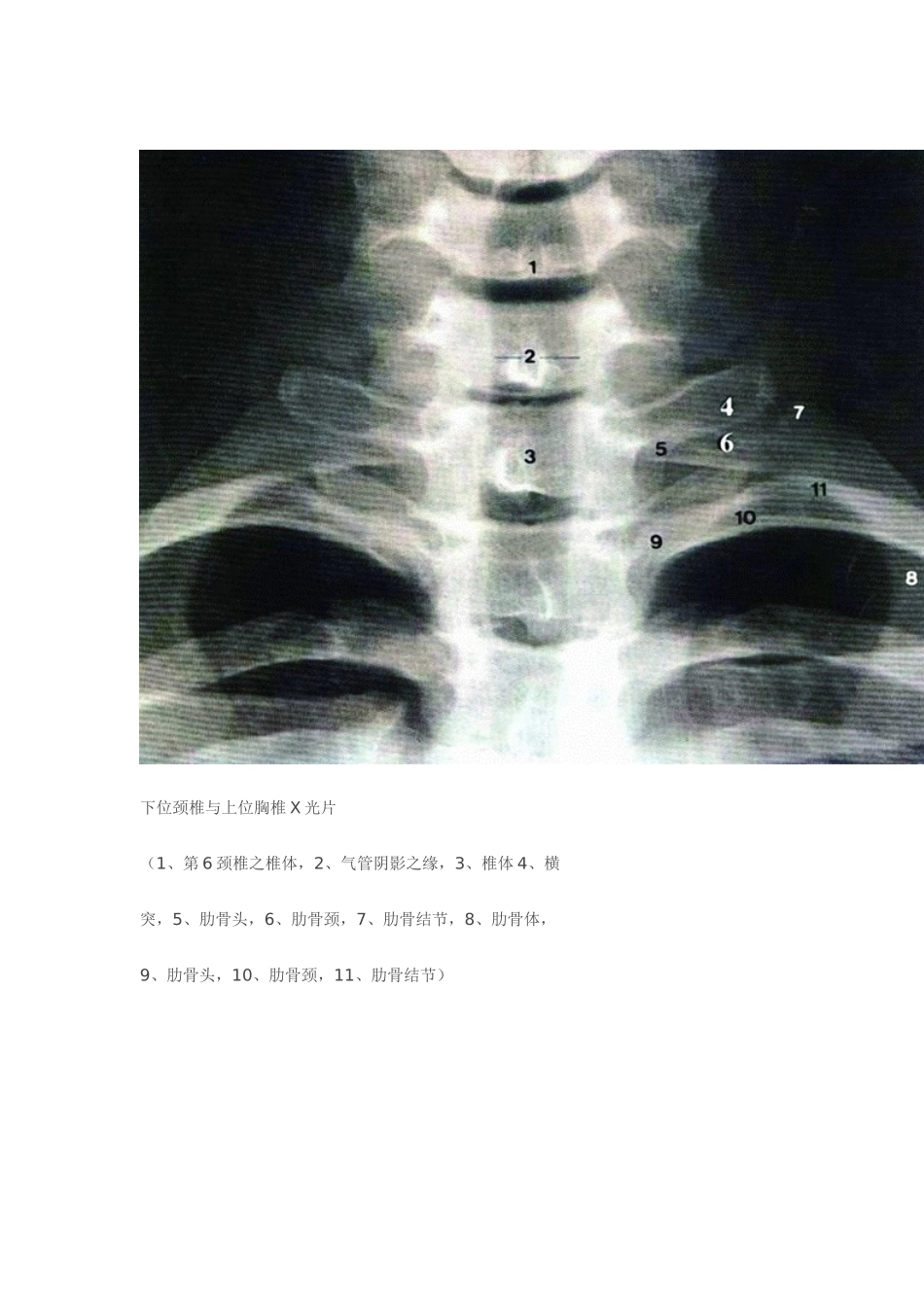 全脊柱影像学诊断_第2页
