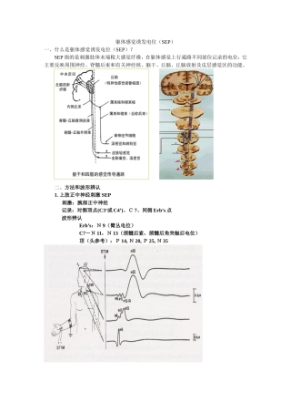 体感诱发电位