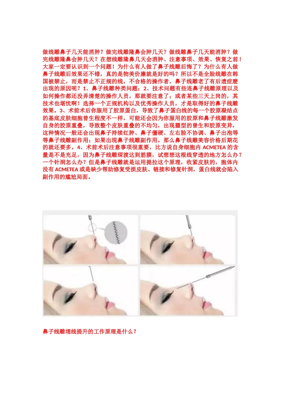 做线雕鼻子几天能消肿？做完线雕隆鼻会肿几天？_第1页