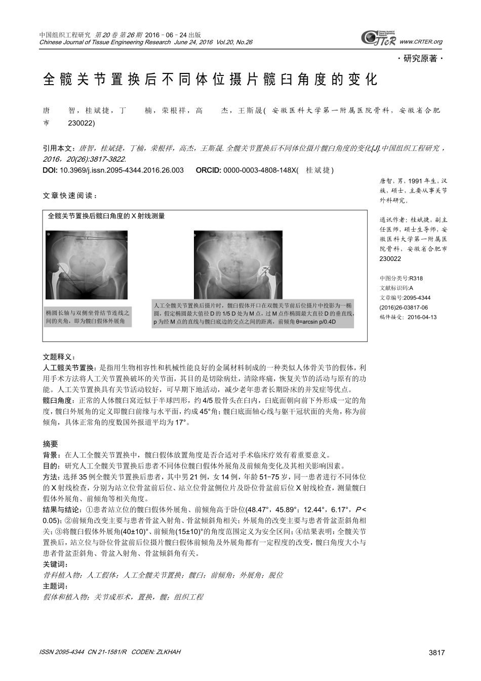 全髋关节置换后不同体位摄片髋臼角度的变化_第1页