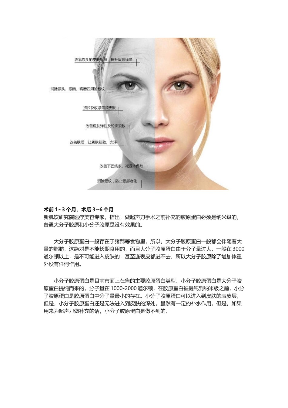 全脸超声刀保持多久？全脸超声刀多久见效？_第3页