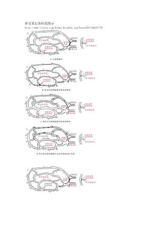 休克笔记各阶段图示
