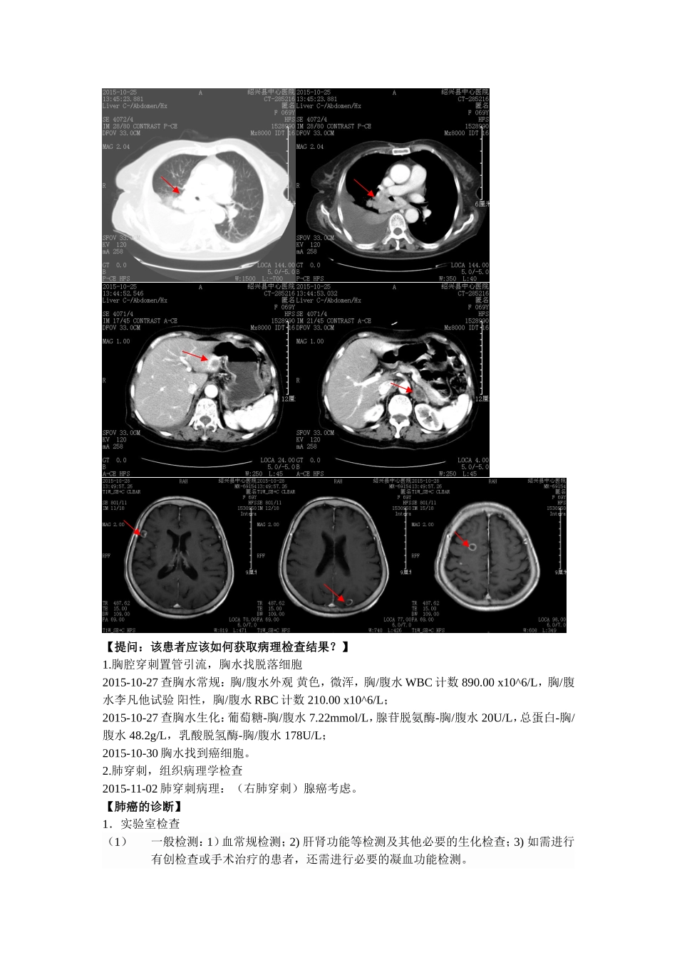 住院医师规范化培训：肿瘤内科教学查房教案_第3页