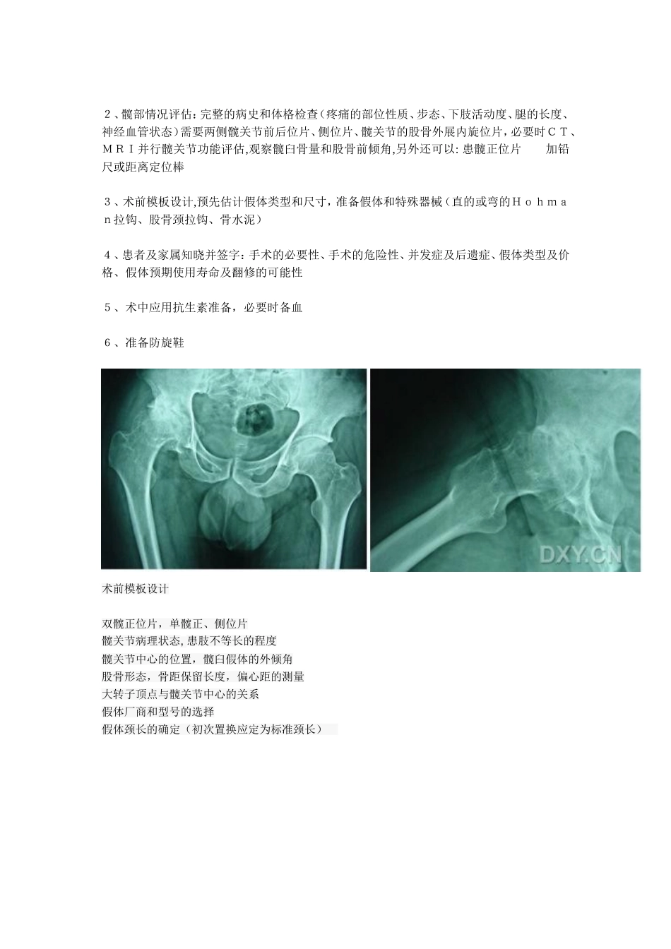 初次全髋置换术的手术技术和容易出现的问题_第2页