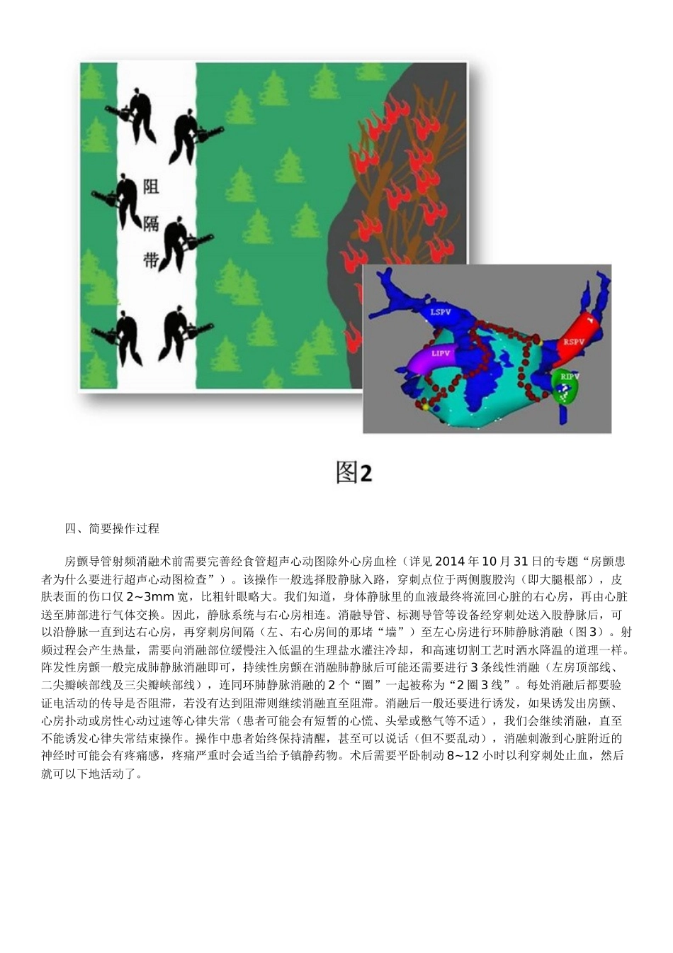 初识房颤导管射频消融术_第3页
