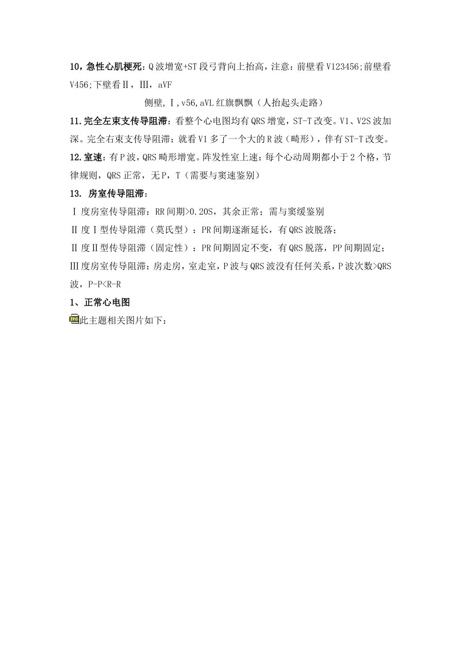 典型心电图讲解_第2页