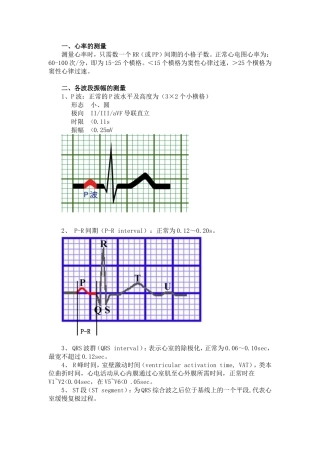 典型心电图详细讲解