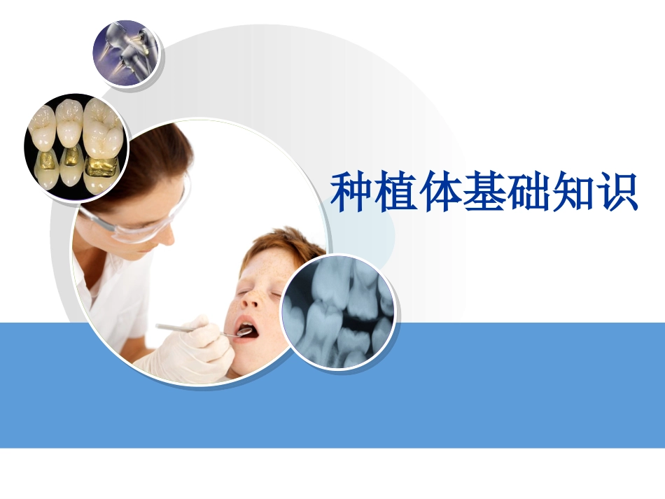 种植体基础知识_第1页