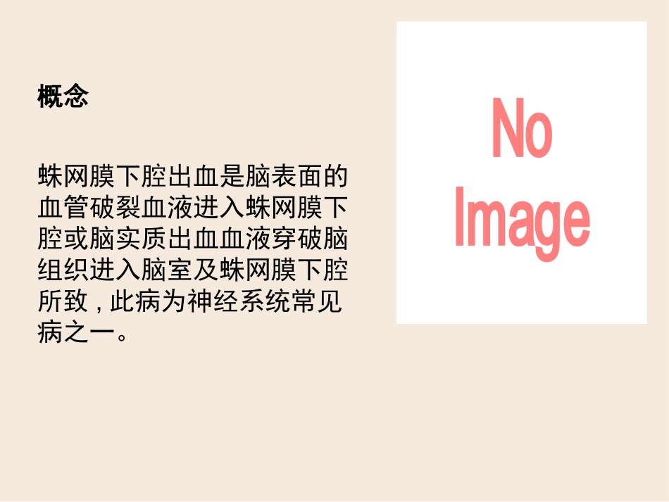 蛛网膜下腔出血出血的护理_第2页