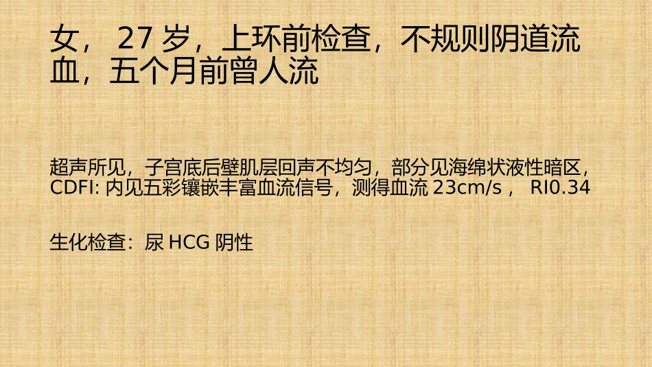 子宫动静脉瘘_第2页