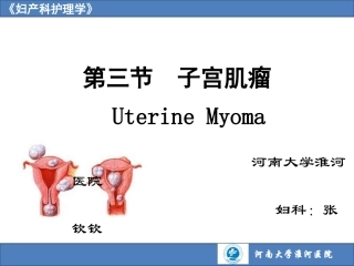 子宫肌瘤护理查房