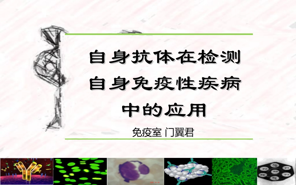 自身抗体在检测自身免疫性疾病中的应用_第1页