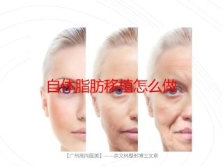 自体脂肪移植怎么做