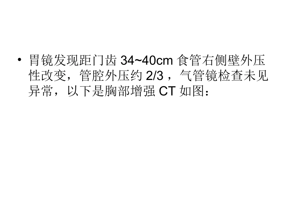 纵隔型肺癌综述_第2页