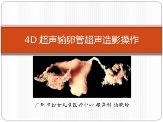 4D超声输卵管超声造影操作