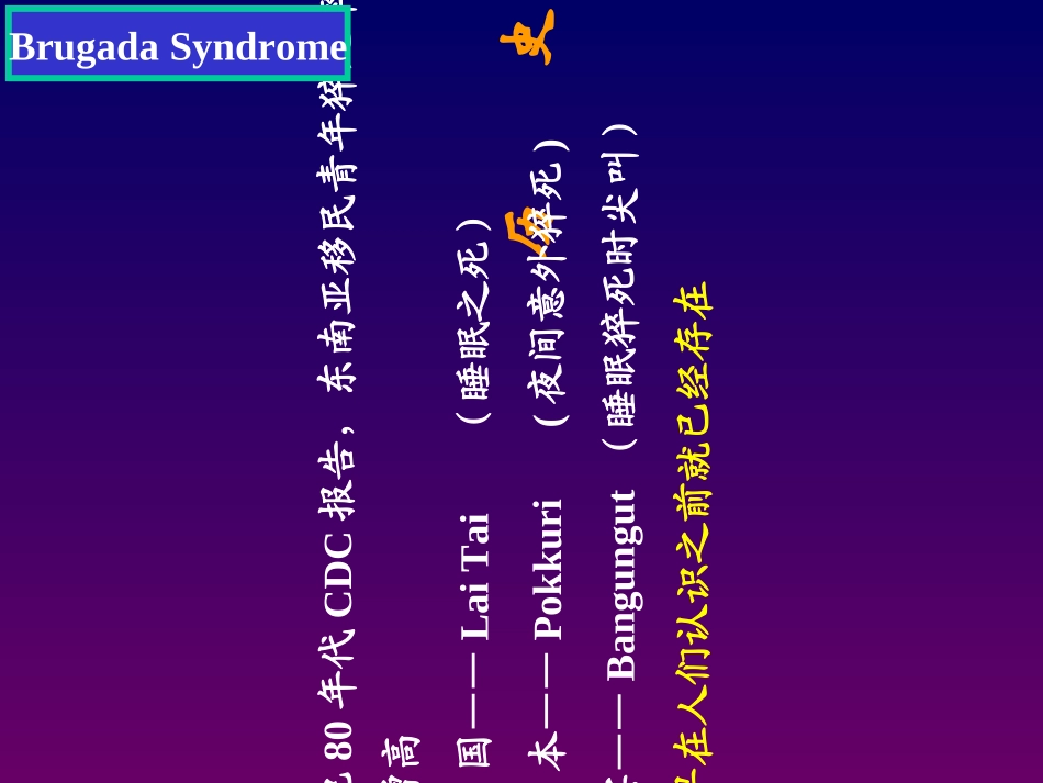 BRUGADA综合征优质课件_第2页
