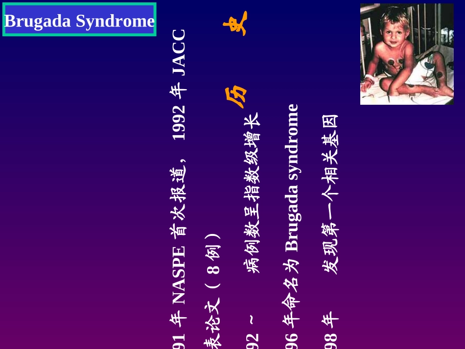 BRUGADA综合征优质课件_第3页