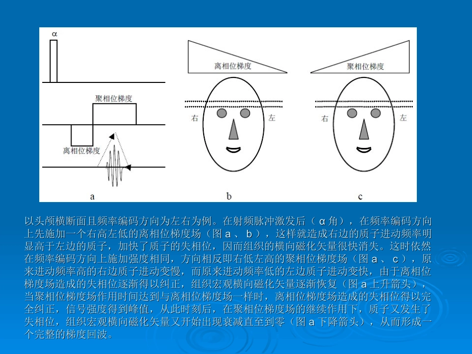 GRE梯度回波序列的原理和临床_第3页