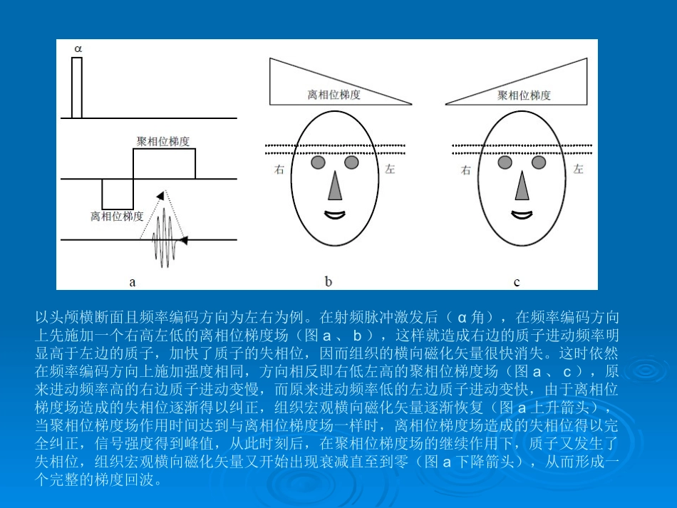 GRE梯度回波序列原理和临床_第3页