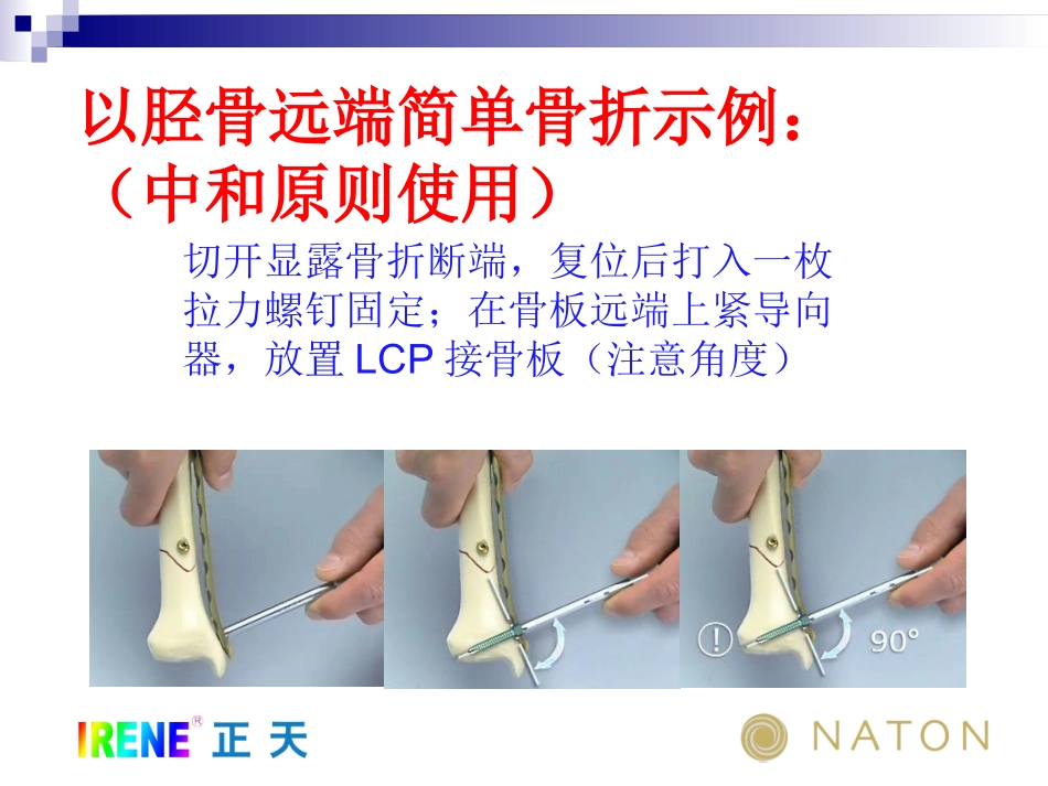 LCP操作指南中和和桥接原则的使用_第2页